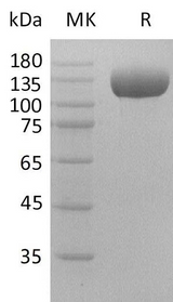 Recombinant Human DPP4/DPPIV/CD26 Protein (Fc Tag) - ABMIUM