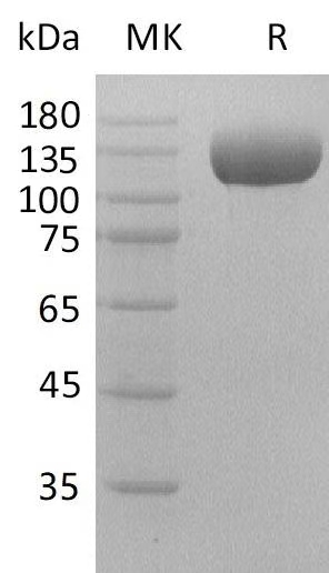 Recombinant Human DPP4/DPPIV/CD26 Protein (Fc Tag) - ABMIUM