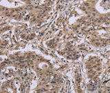 Anti-Human/Mouse IPO8 Antibody - ABMIUM