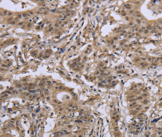 Anti-Human/Mouse IPO8 Antibody - ABMIUM