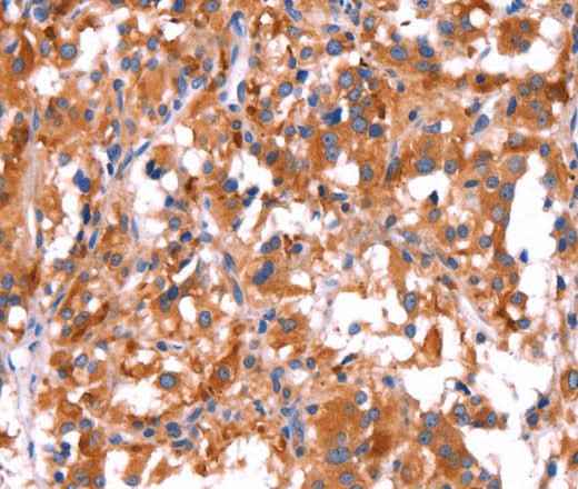Anti-Human/Mouse/Rat GCG Antibody