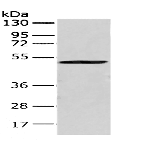 Anti-Human CRTAM Antibody - ABMIUM
