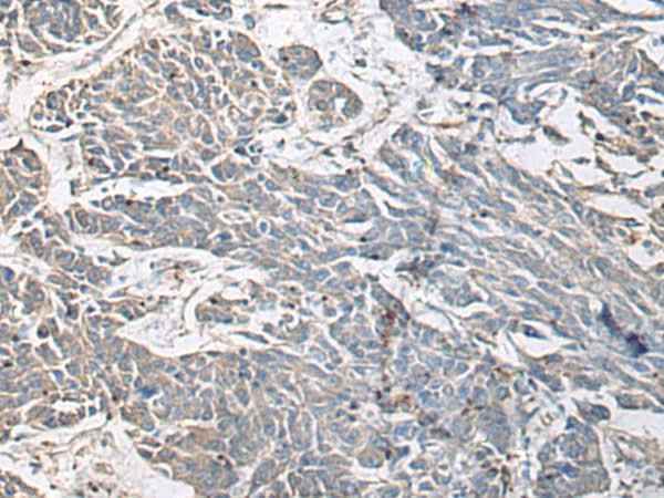 Anti-Human/Mouse PRKCSH Antibody