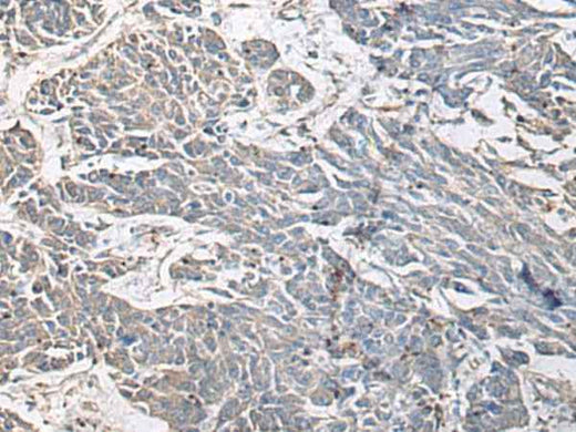 Anti-Human/Mouse PRKCSH Antibody