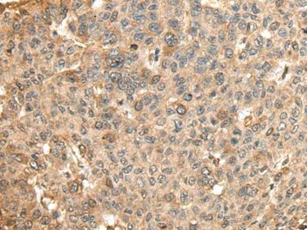 Anti-Human HMMR Antibody