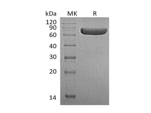 Recombinant Human TNFRSF1B/CD120b Protein (Fc Tag) - ABMIUM