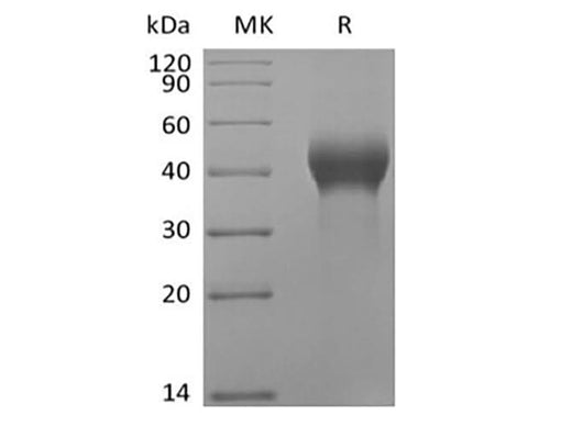 Recombinant Human Dickkopf-Related Protein 1/DKK-1 (C-Avi-6His) Biotinylated - ABMIUM