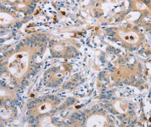 Anti-Human KLK4 Antibody