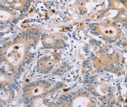 Anti-Human KLK4 Antibody - ABMIUM