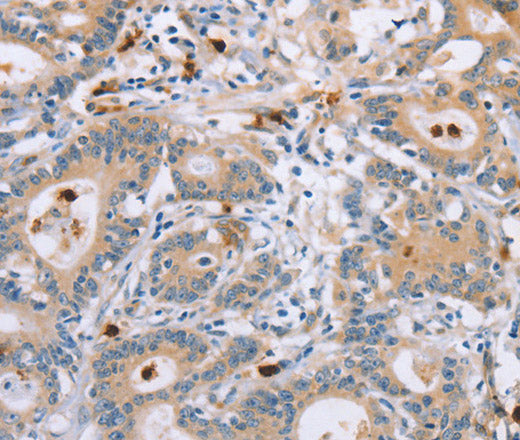 Anti-Human KLK4 Antibody - ABMIUM