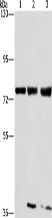 Anti-Human/Mouse/Rat GGCX Antibody - ABMIUM