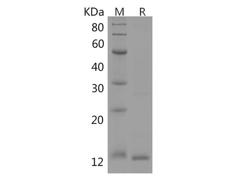 SDS-PAGE analysis of Human MCP3/CCL7 proteins, 2 μg/lane of Recombinant Human MCP3/CCL7 proteins was resolved with SDS-PAGE under reducing conditions, showing bands at 10 kDa.