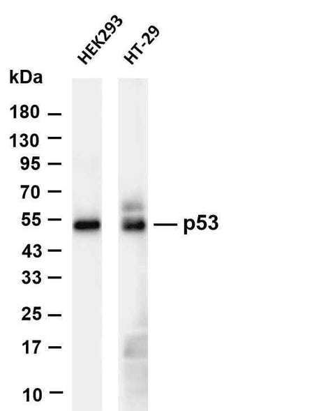 Anti-Human p53 Antibody [B1104] - ABMIUM