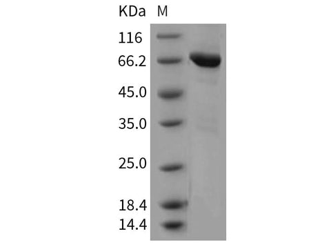 > 91 % as determined by reducing SDS-PAGE.