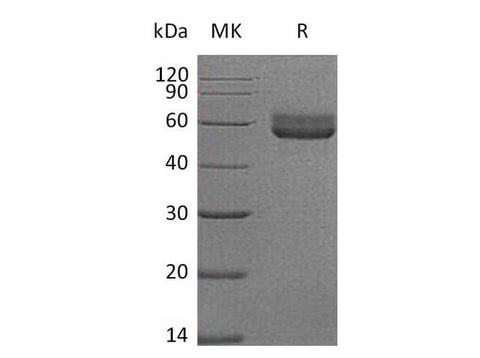 Recombinant Mouse HVEM/TNFRSF14 Protein (Fc Tag) - ABMIUM