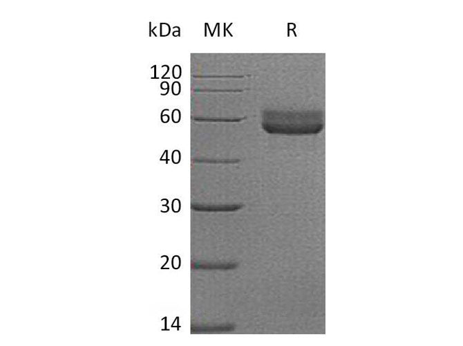 Recombinant Mouse HVEM/TNFRSF14 Protein (Fc Tag) - ABMIUM