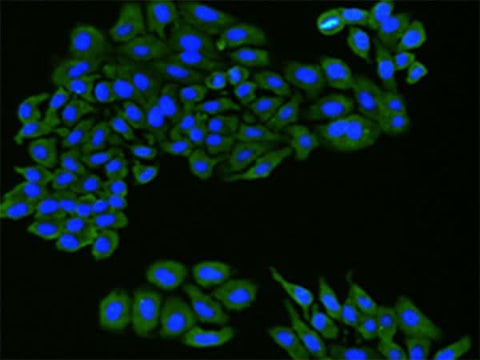 Immunofluorescence analysis of hepG2 cell using FLT1 Polyclonal Antibody at dilution of 1:100