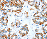 Anti-Human/Mouse/Rat ALDH5A1 Antibody - ABMIUM