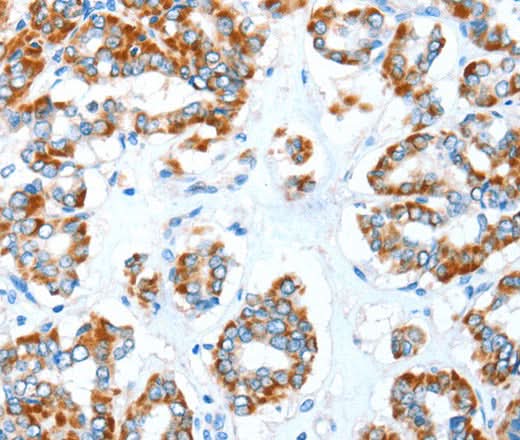 Anti-Human/Mouse/Rat ALDH5A1 Antibody - ABMIUM