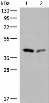 Anti-Human/Mouse/Rat GIPC1 Antibody - ABMIUM