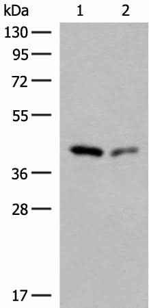 Anti-Human/Mouse/Rat GIPC1 Antibody