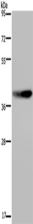 Anti-Human/Mouse/Rat MKP-2 Antibody - ABMIUM