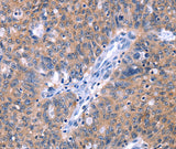 Anti-Human ZNF395 Antibody - ABMIUM