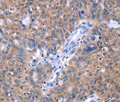 Anti-Human ZNF395 Antibody
