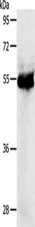 Anti-Human/Mouse/Rat PRKAR1B Antibody - ABMIUM