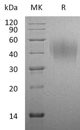 Recombinant Rat CD86/B7-2 Protein (His Tag) - ABMIUM