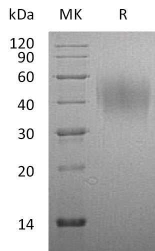 Recombinant Rat CD86/B7-2 Protein (His Tag) - ABMIUM