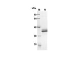 SDS-PAGE analysis of Human IGFBP2 proteins, 2 μg/lane of Recombinant Human IGFBP2 proteins was resolved with an SDS-PAGE under reducing conditions, showing bands at 31.7 kDa.
