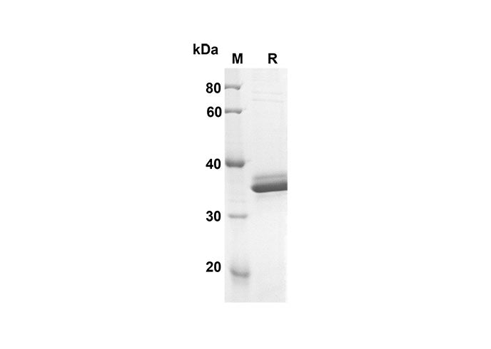 SDS-PAGE analysis of Human IGFBP2 proteins, 2 μg/lane of Recombinant Human IGFBP2 proteins was resolved with an SDS-PAGE under reducing conditions, showing bands at 31.7 kDa.