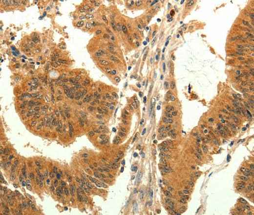 Anti-Human/Mouse/Rat TRPM7 Antibody