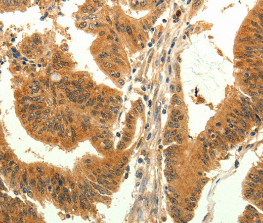 Anti-Human/Mouse/Rat TRPM7 Antibody - ABMIUM