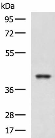 Western blot analysis of K562 and HepG2 cell lysates using RBM4 Polyclonal Antibody at dilution of 1:750