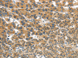 Anti-Human/Mouse UBTD2 Antibody - ABMIUM