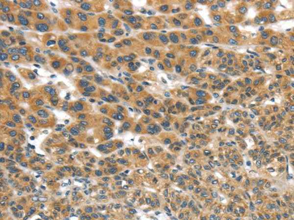 Anti-Human/Mouse UBTD2 Antibody