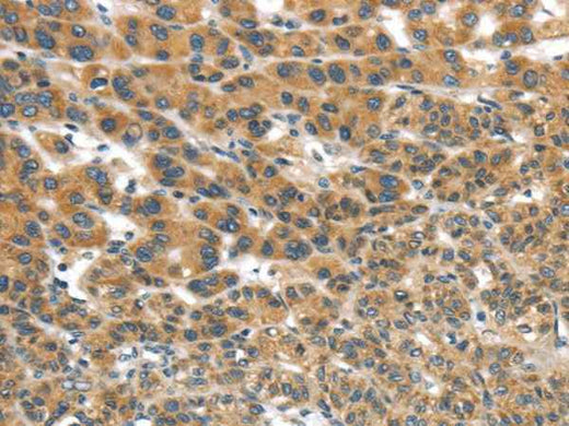 Anti-Human/Mouse UBTD2 Antibody