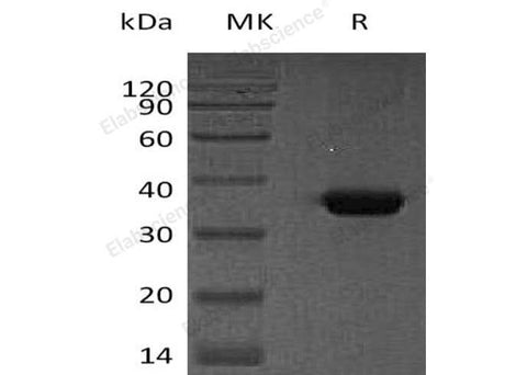 Recombinant Human Osteonectin/SPARC Protein (His Tag) - ABMIUM