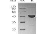 Recombinant Human UROD Protein (His Tag) - ABMIUM