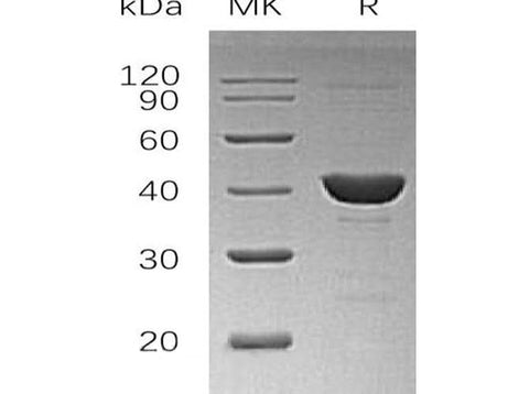 Recombinant Human UROD Protein (His Tag) - ABMIUM