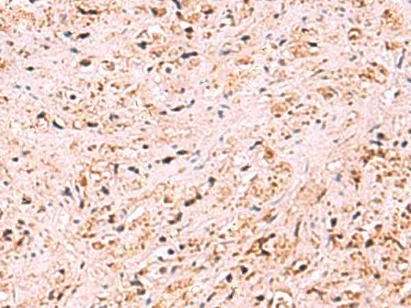 Anti-Human/Mouse ZSWIM1 Antibody