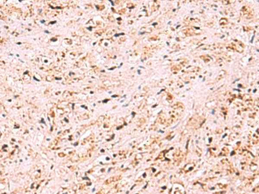 Anti-Human/Mouse ZSWIM1 Antibody