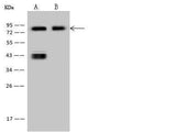 Anti-Human CD44 Antibody [A1150] - ABMIUM