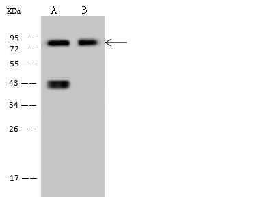 Anti-Human CD44 Antibody [A1150] - ABMIUM