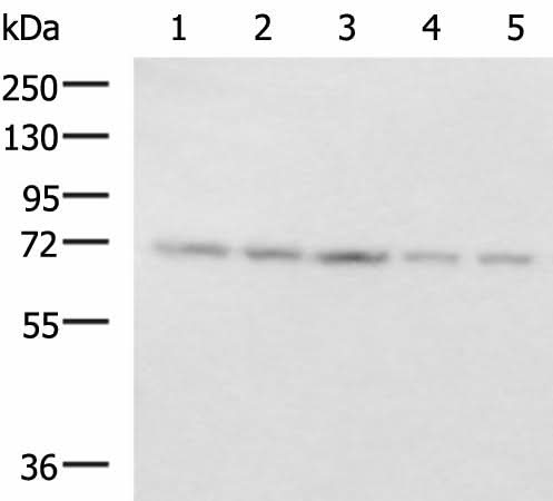 Western blot analysis of 293T PC3 cell Mouse liver tissue and Mouse kidney tissue lysates using PAIP1 Polyclonal Antibody at dilution of 1:800