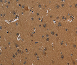 Anti-Human CD242 Antibody - ABMIUM