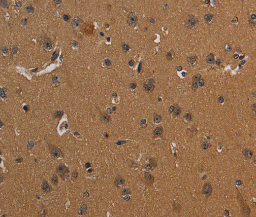 Anti-Human CD242 Antibody - ABMIUM