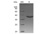 Recombinant Human STING/TMEM173 Protein (Sumo & His Tag) - ABMIUM